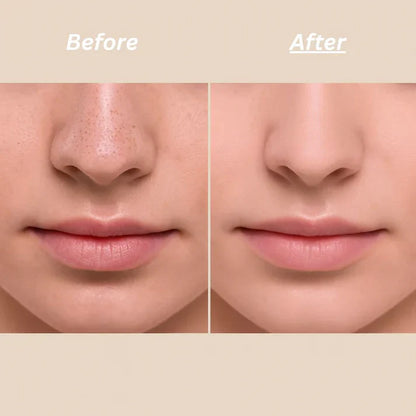 Dr.Melaxin Peel Shot Ampoule