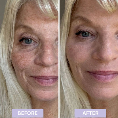 Buy One Get One Free -  Biomimic® Foundation